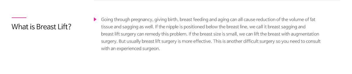 처진 가슴 교정술이란 - 임신과 출산, 그리고 나이가 듦에 따라 피부의 탄력이 떨어지게 되면 유선 및 지방 조직의 탄력도 저하될 수 있습니다. 유방하수(처진가슴)은 위와 같은 이유로 유두가 유방 밑 주름보다 아래쪽에 위치하는 경우를 말하며 처진 가슴을 올려주고 탄력을 높여주는 수술을 유방하수 교정수술이라 합니다. 가슴이 작은 경우에는 가슴 확대술로 유방하수를 개선할 수 있으나, 가슴 크기와는 별개로 처지기만 한 경우에는 유방하수 교정술을 시행해야 보다 좋은 결과를 얻을 수 있습니다. 난이도가 높은 수술이기 때문에 풍부한 임상 경험의 전문의에게 수술을 받으셔야 합니다.