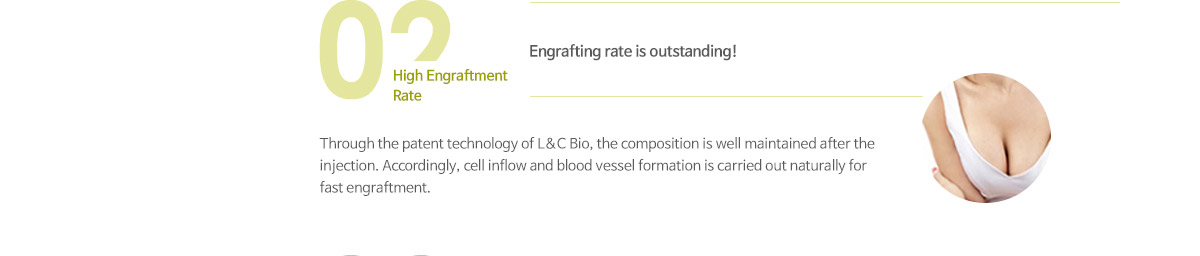 휴먼콜라겐필러 레지나볼륨 소개, 특장점 - 둘 높은 생착률 : L&C Bio만의 특허 받은 기술공정을 이용하여 세포 외 기질 구조를 그대로 유지하므로 주입 후 혈관형성과 세포 유입이 자연스럽게 이루어져 이물 반응 없이 빠른 생착이 이루어집니다.