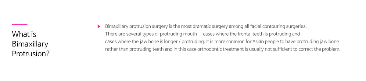 돌출입 수술이란 - 양악 치조 돌출 증 교정수술은 안면 윤곽수술 중에서도 가장 드라마틱하고 효과적인 수술입니다. 돌출 입은 앞니의 치아와 잇몸이 유난히 튀어나온 형태를 말하여, 치아만 앞으로 나오거나 잇몸 뼈 자체가 튀어나온 형태 등 여러 가지 유형이 잇습니다. 동양인은 치아만 돌출된 경우 보다 잇몸 뼈 자체가 튀어나온 경우가 많은데 이런 경우 치아교정만으로 교정이 어렵기 때문에 잇몸 벼 자체를 밀어 넣어주는 전방분절 절골술을 시행하고복합적인 돌출 입의 경우에는 양악수술이 적합합니다.